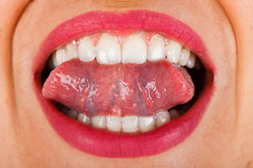 Perfect danture & twisted tongue