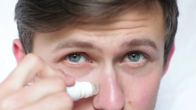 A young man using a remedy for acne and acne on his face