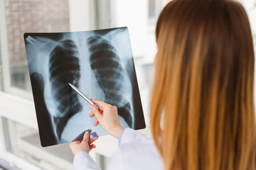 The doctor examines the x-ray image of the patient chest.