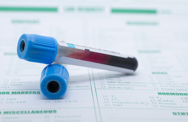 Form to fill in the results of biochemistry blood tests