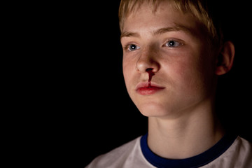 Young blond boy with bloody nose