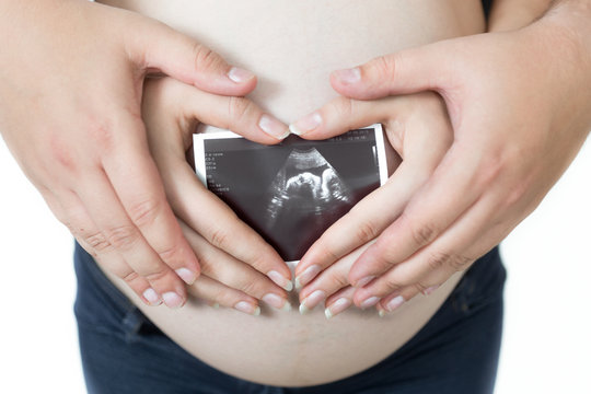Closeup image of pregnant woman and husband holding ultrasound fetus image