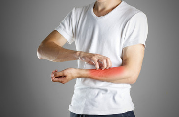 Guy in white shirt scratching his arm. Scabies. Scratch the hand. Isolated