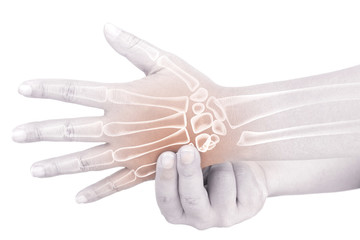 hand bones injury