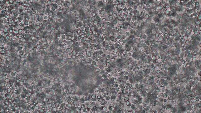 Budding yeast cell under the microscope.