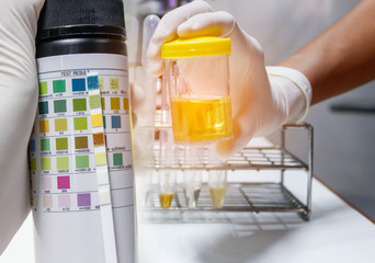 Urine sample