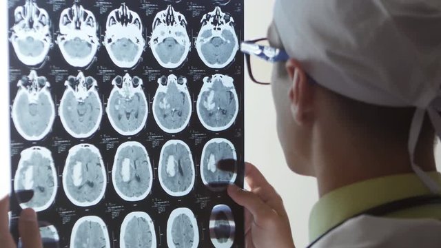 A neurosurgeon doctor looks at a Magnetic resonance imaging MRI snapshot of the brain