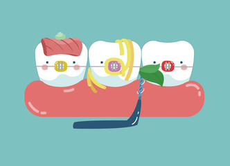 Food stuck teeth, teeth and tooth concept of dental