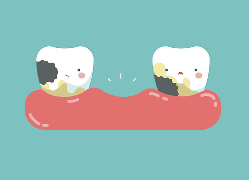 Decayed teeth ,teeth and tooth concept of dental 