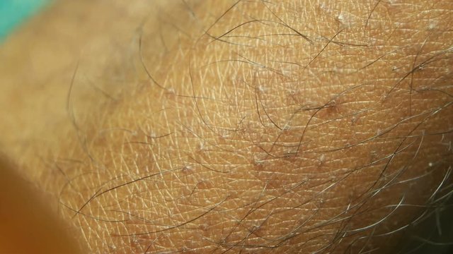 Close up of Human Skin Texture 
