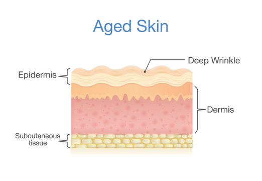 Aged skin layer in 3D vector style. Illustration about health care and beauty.
