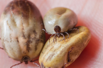 Tick filled with blood sitting on human skin