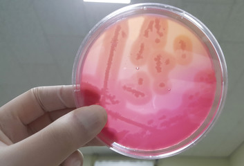 Microbiology Culture Experiment