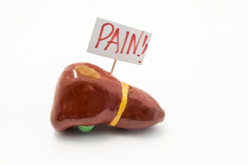 Anatomical model of liver with placard with inscription pain is on white background. Concept photo...