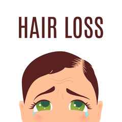Woman suffering from hair loss. Alopecia treatment and transplantation concept. Can be used by clinics and diagnostic centers. Isolated vector illustration.