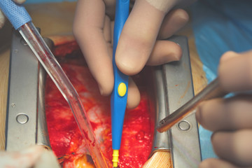 Work in the operating field during surgery