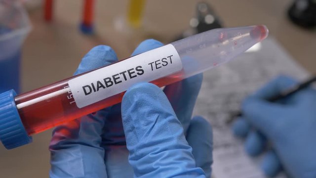 Scientist holding a diabetes test tube while taking some notes observations in a notebook. Filmed in a lab environment. Closeup on the tube.