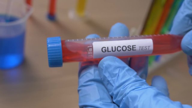 Scientist holding a Glucose test tube while taking some notes observations in a notebook. Filmed in a lab environment. Closeup on the tube.