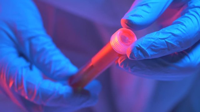 Scientist holding a blood test tube in his hands wearing gloves.