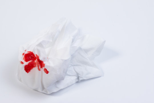 Wound blood, blood on tissue paper on white background. Nosebleed or epistaxis treatment blood in tissue paper. Health medical.