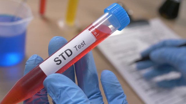 Scientist holding a STD test tube while taking some notes observations in a notebook. Filmed in a lab environment. Closeup on the tube.