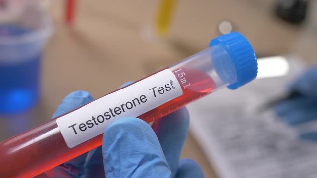 Scientist holding a testosterone test tube while taking some notes observations in a notebook. Filmed in a lab environment. Closeup on the tube.