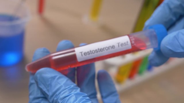 Scientist holding a testosterone test tube filled with a red substance. Filmed in a lab environment. Closeup on the tube.