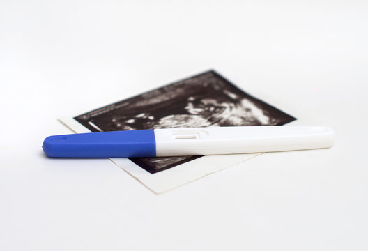 Plastic pregnancy test and ultrasound picture.