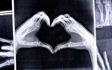X-ray image of hands making heart symbols.