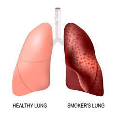 healthy lungs and smoker's lungs
