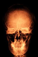 Human skull head scan as scary halloween background 