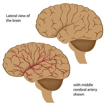 Lateral view of the brain with arteries