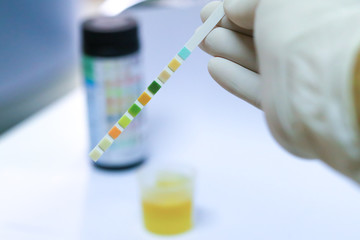 Reagent Strip for Urinalysis, Routine Urinalysis, check-up analysis in laboratory, Check-up. Medical report and urine test strips.