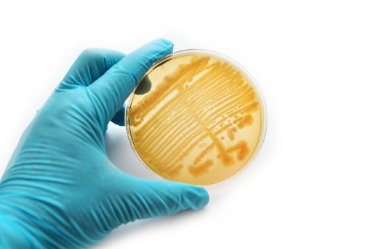 Colonies of bacteria in petri dish 
