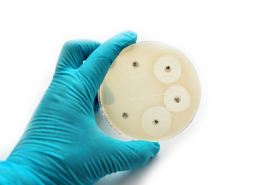 Antimicrobial susceptibility testing in petri dish