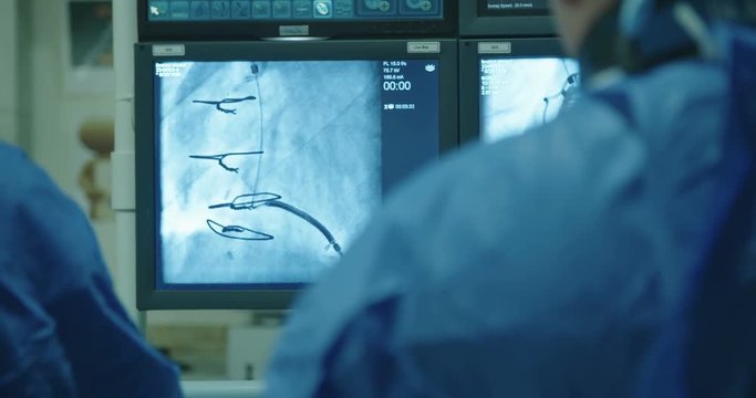 Surgeons watching monitors with x-ray images during a Cardiac catheterization procedure