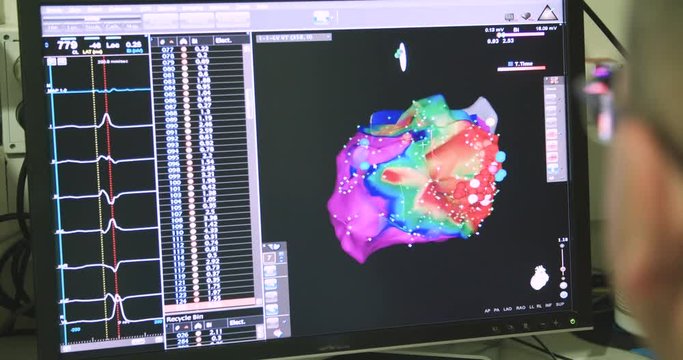 Surgeons watching monitors with x-ray images during a Cardiac catheterization procedure