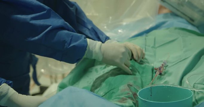 Surgeons inserting a catheter during a Cardiac catheterization in a hospital