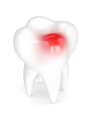 3d render of tooth with toothache over white