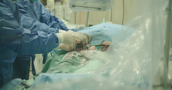 Surgeons inserting a catheter during a Cardiac catheterization in a hospital