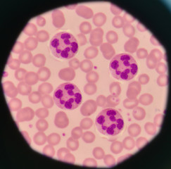 White blood cells on red blood cells background.