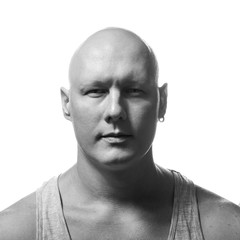 Autoimmune total alopecia men portrait. Absolute bald head without eyebrows