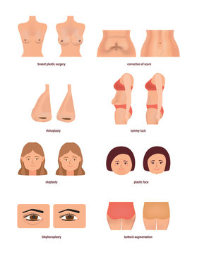 Modern medicine and healthcare concept. Different types of plastic surgery.