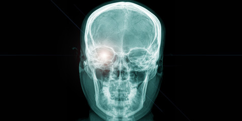 x ray of human head with shining eye