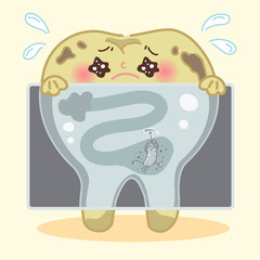 tooth decay with xray