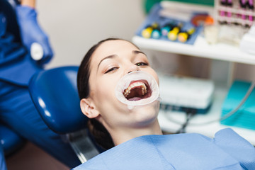 The girl patient with a retractor at the dentist office