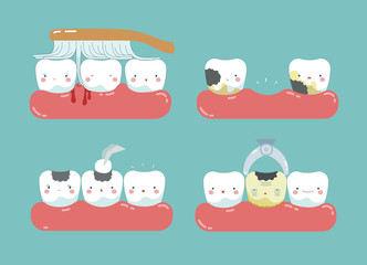 Obraz premium Brushing make hurt gum and teeth, decayed teeth ,filling tooth of dental set