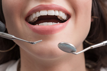 Close-up of female with open mouth during oral checkup at the dentist.Dentist