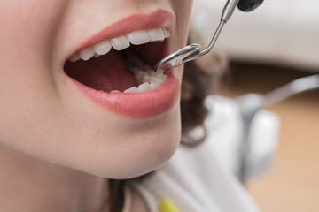 Close-up of female with open mouth during oral checkup at the dentist.Dentist