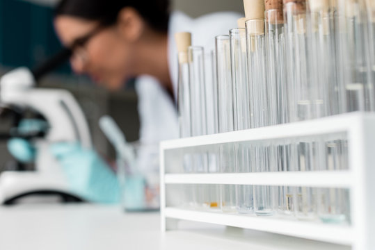 Close-up view of test tubes with reagents and samples on table in chemical lab